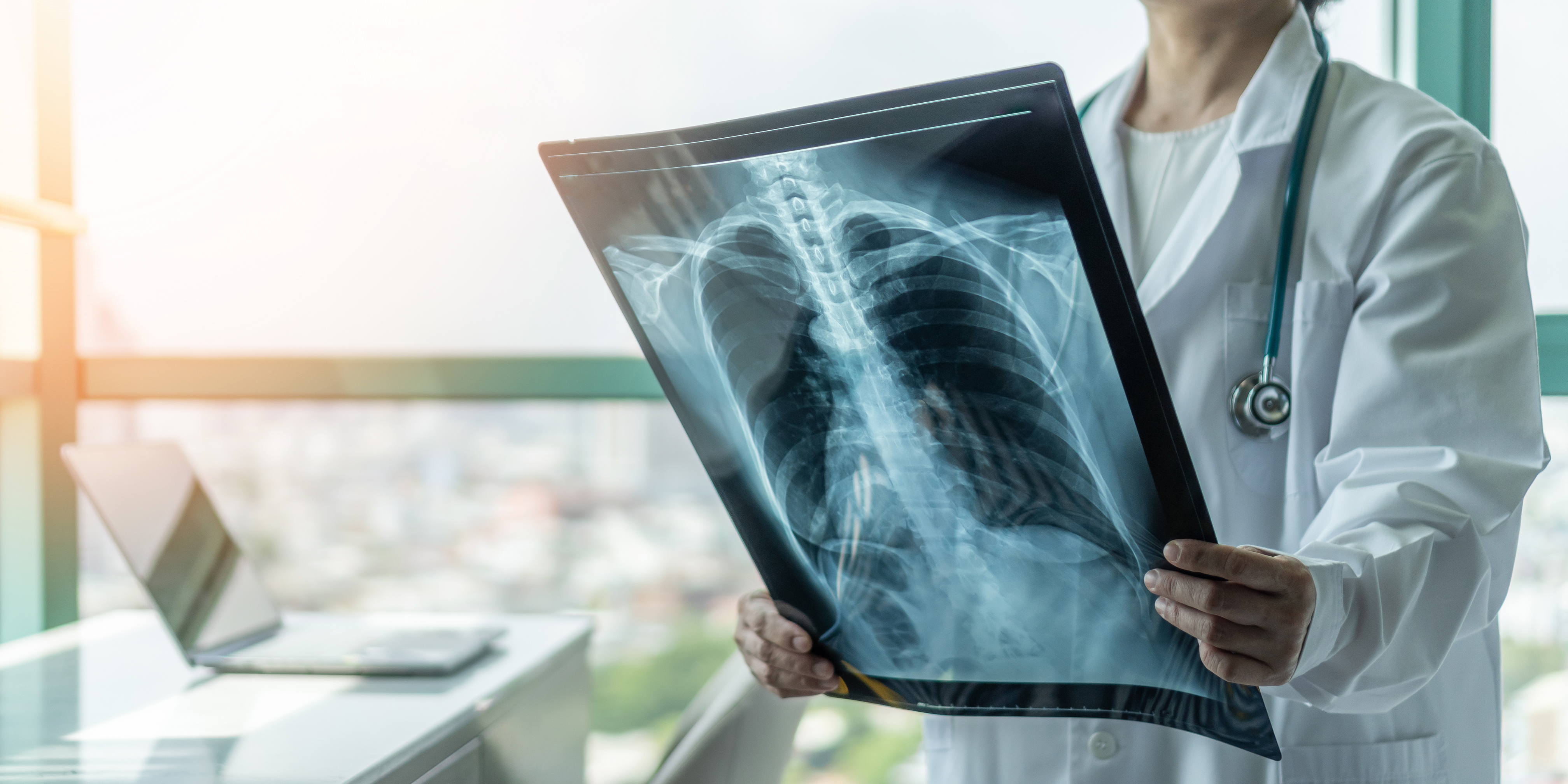 NP Interpreting Extremity X-Ray
